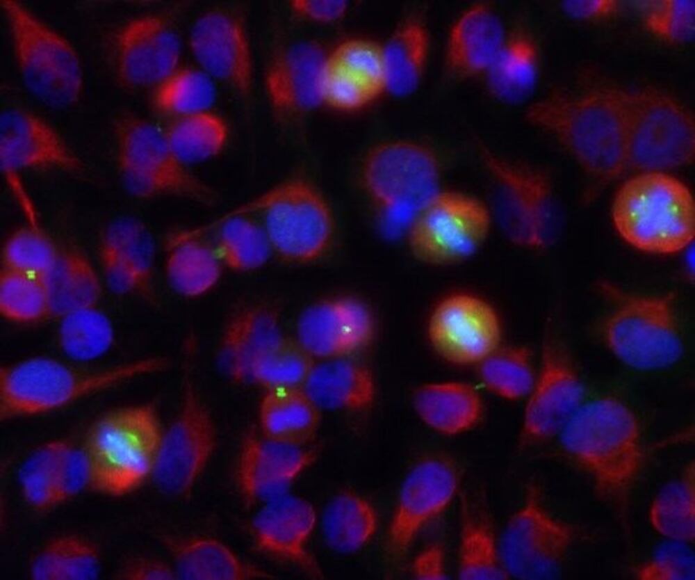 Anti-Aurora A + B Kinase Antibody [3H1]