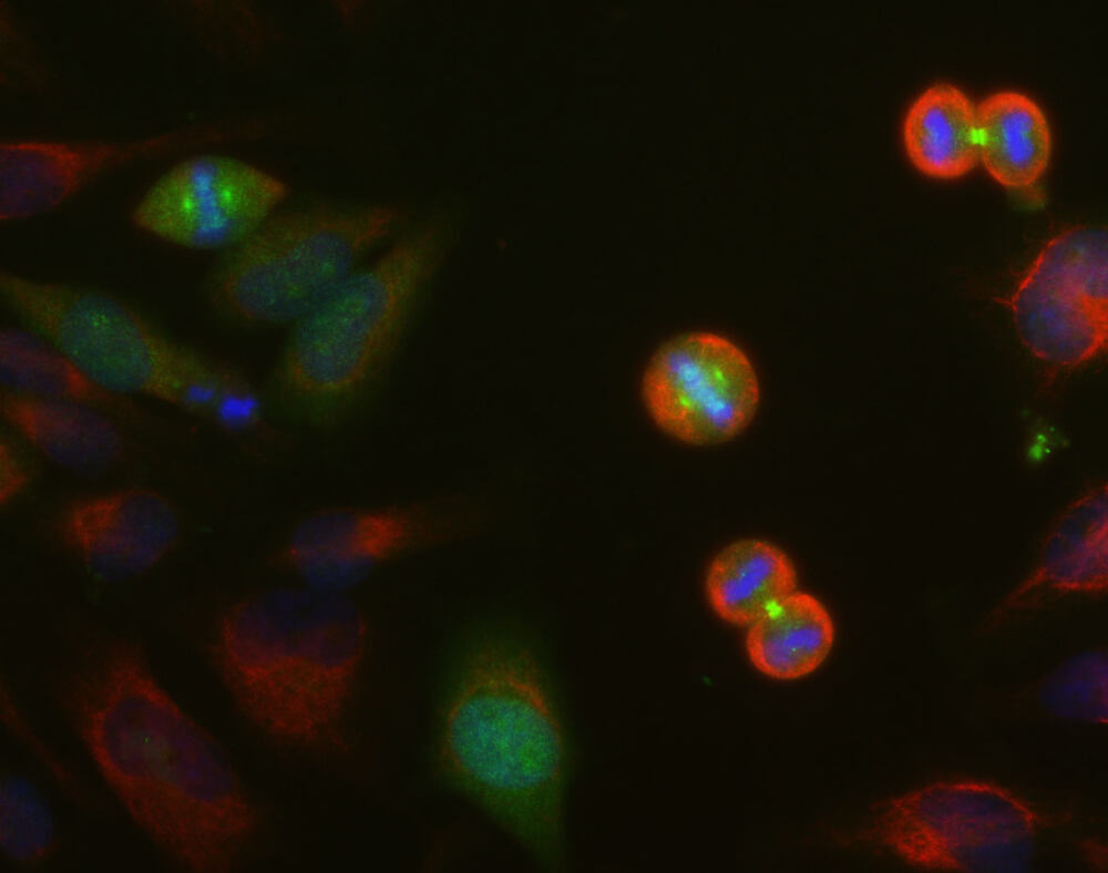 Anti-Aurora A + B + C Kinase Antibody [4, A7]