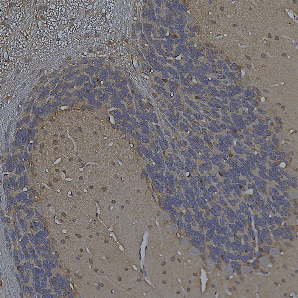 Anti-Enolase 1 Antibody [253]