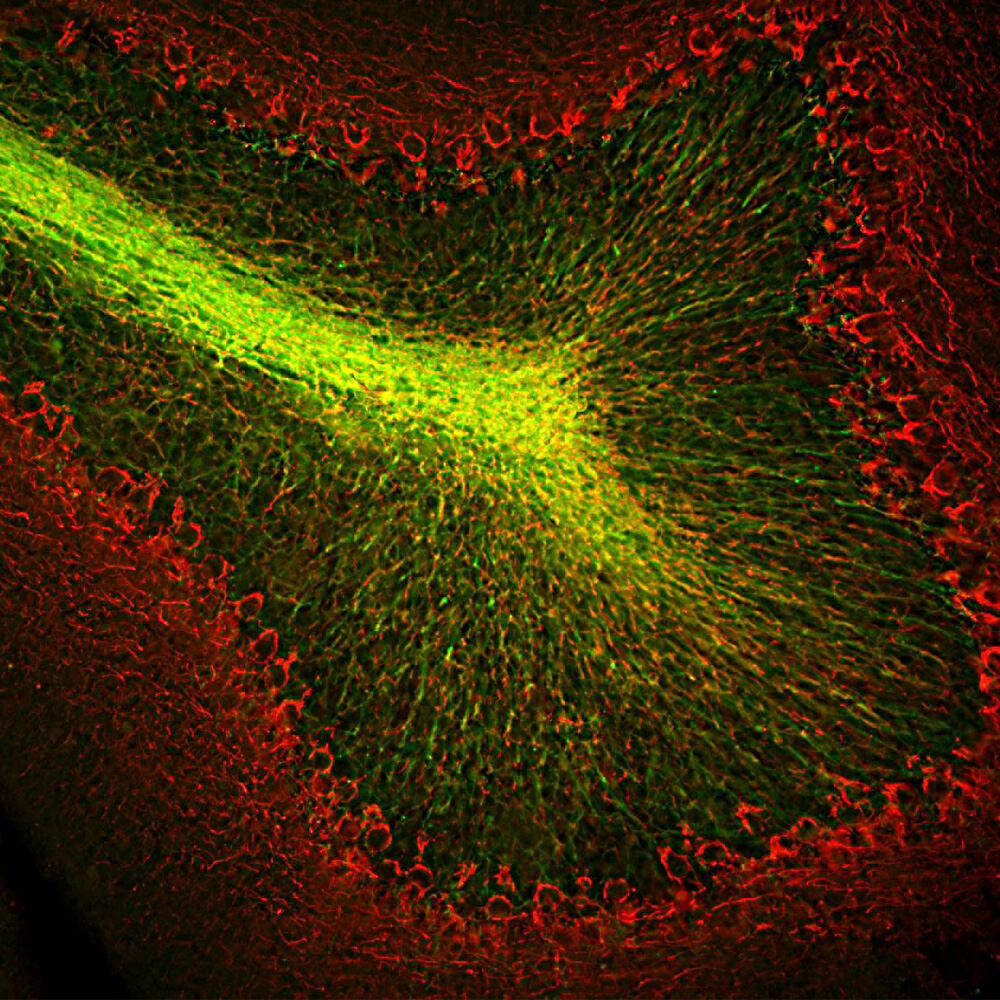 Anti-CNPase Antibody [1H10]