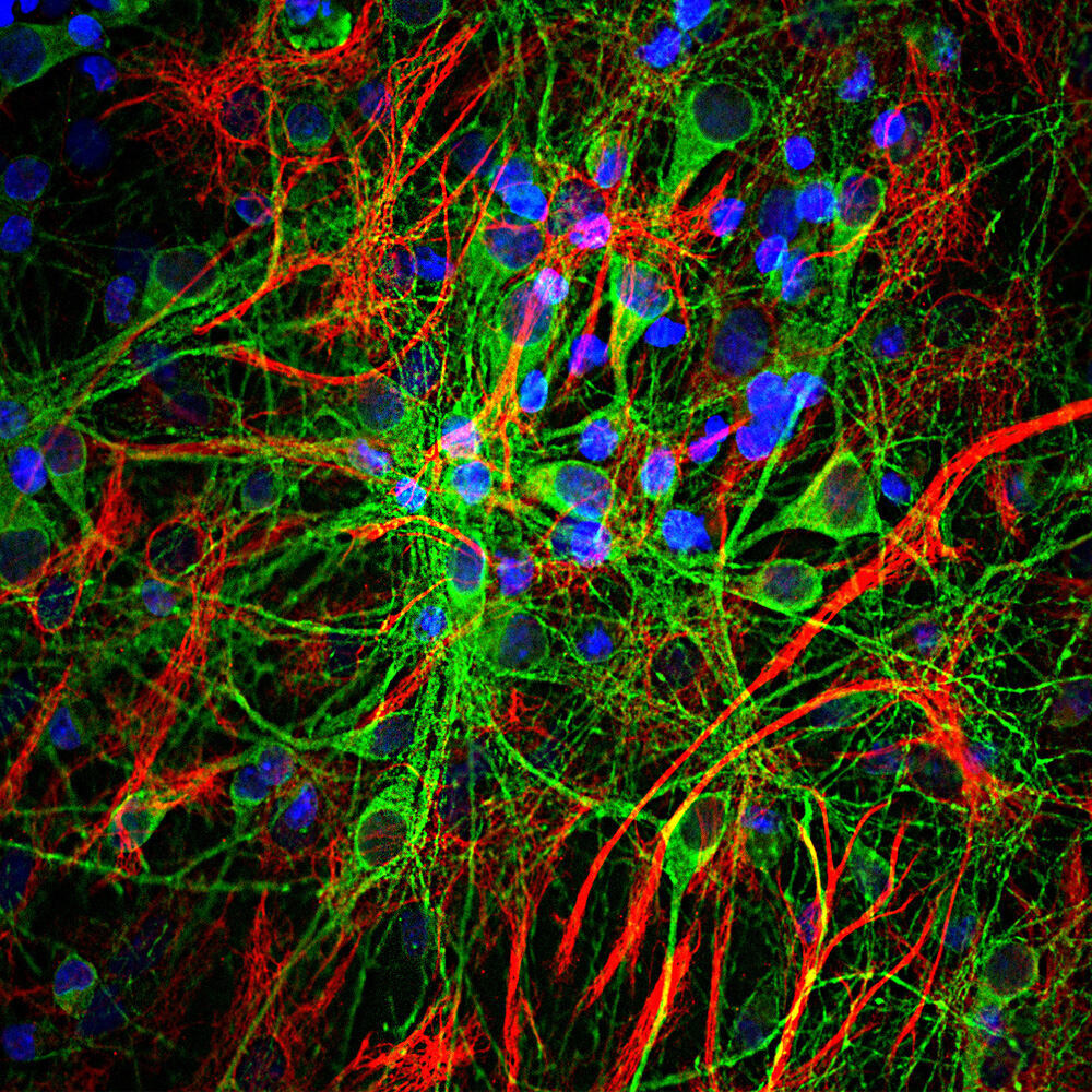 Anti-Tau Antibody [5B10]