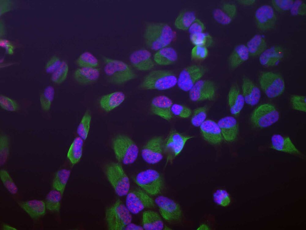 Anti-SF3B4 Antibody [3A1], 100 µl