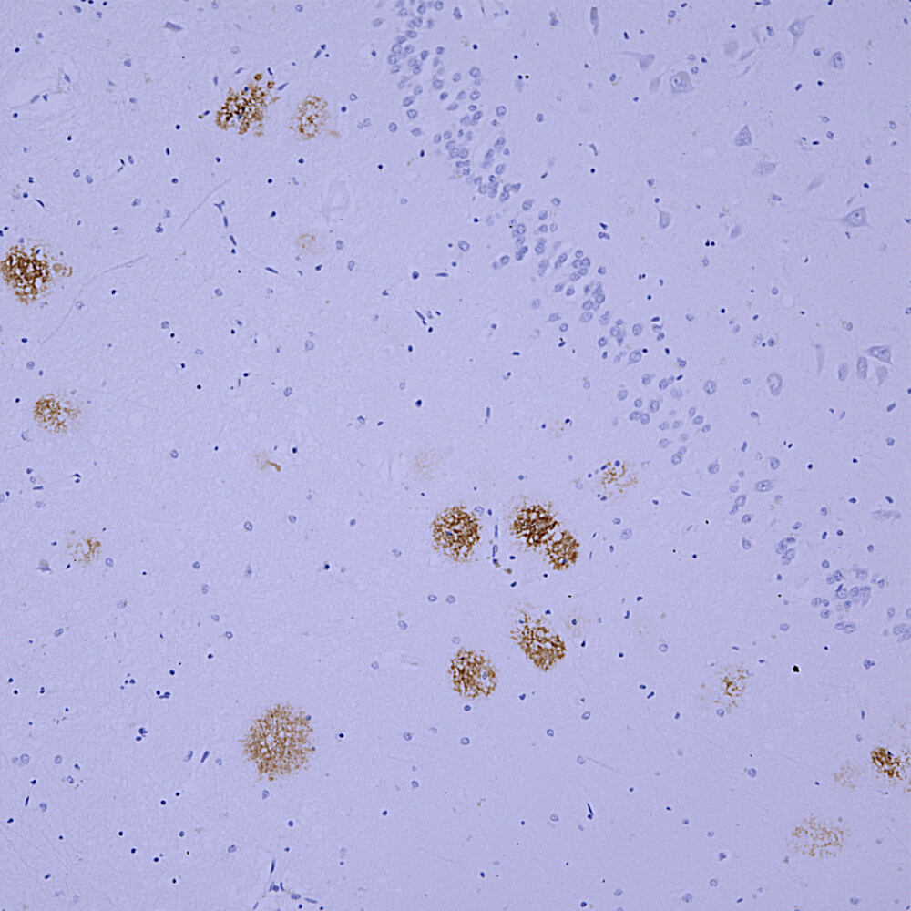 Anti-beta Amyloid Antibody [AB9], 100 µl
