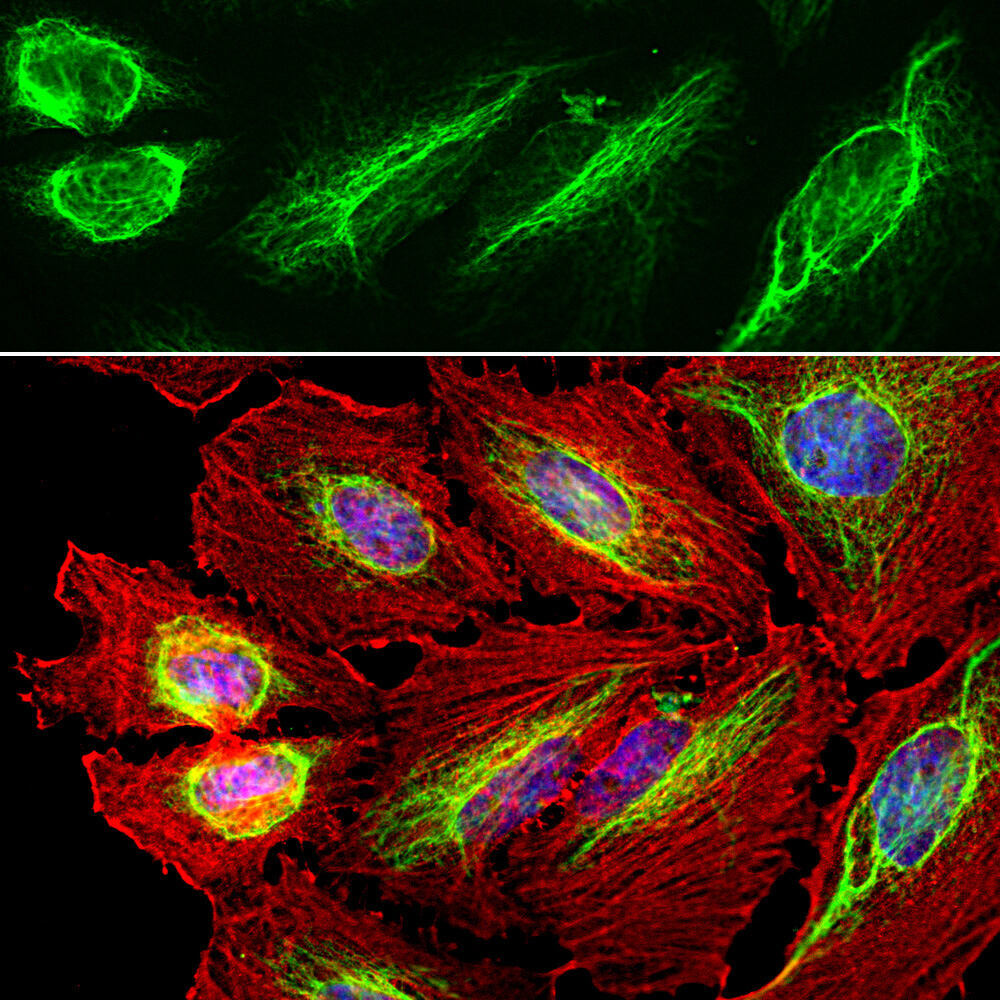 Anti-Vimentin Antibody