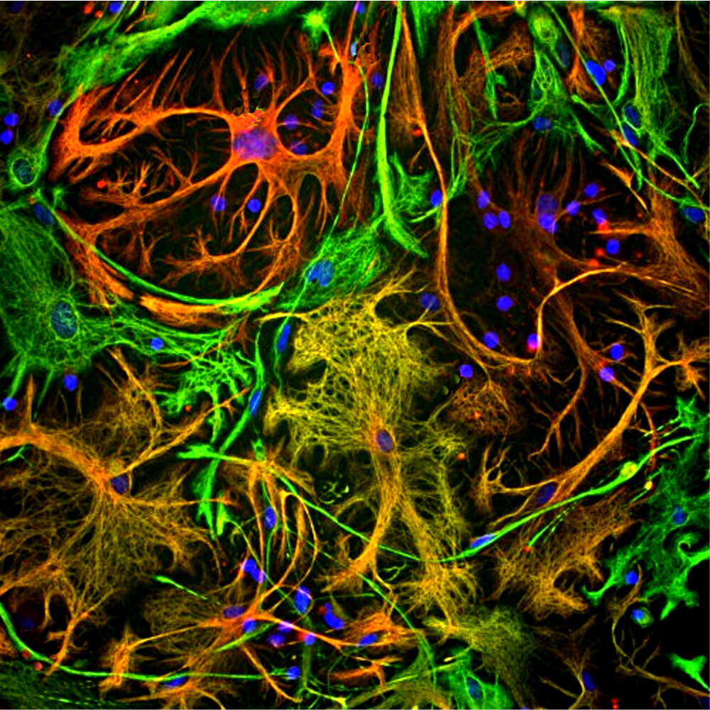 Anti-Vimentin Antibody [2A52]