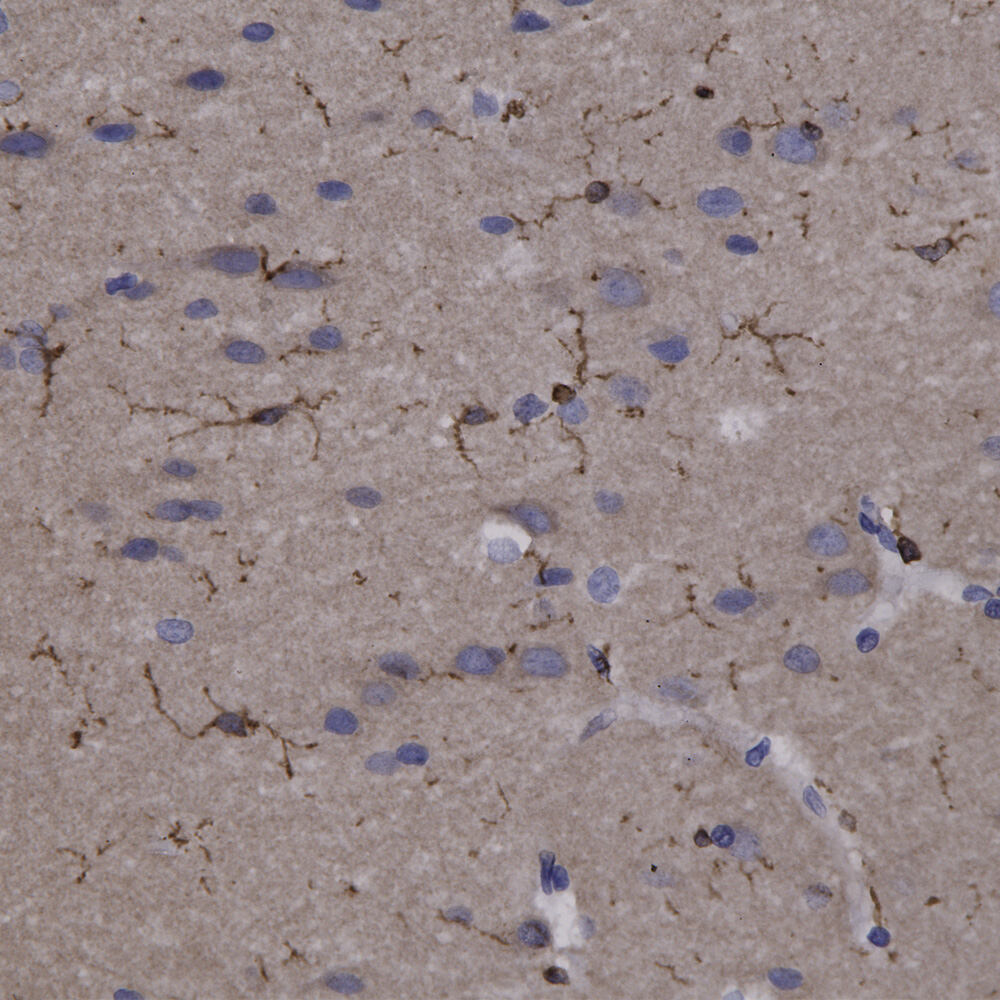 Anti-Coronin 1a Antibody
