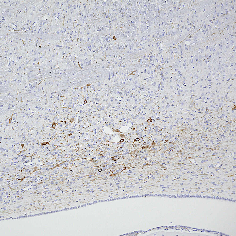 Anti-Peripherin Antibody [7C5]
