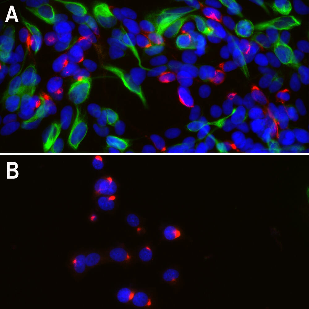 Anti-Peripherin Antibody [8G2]