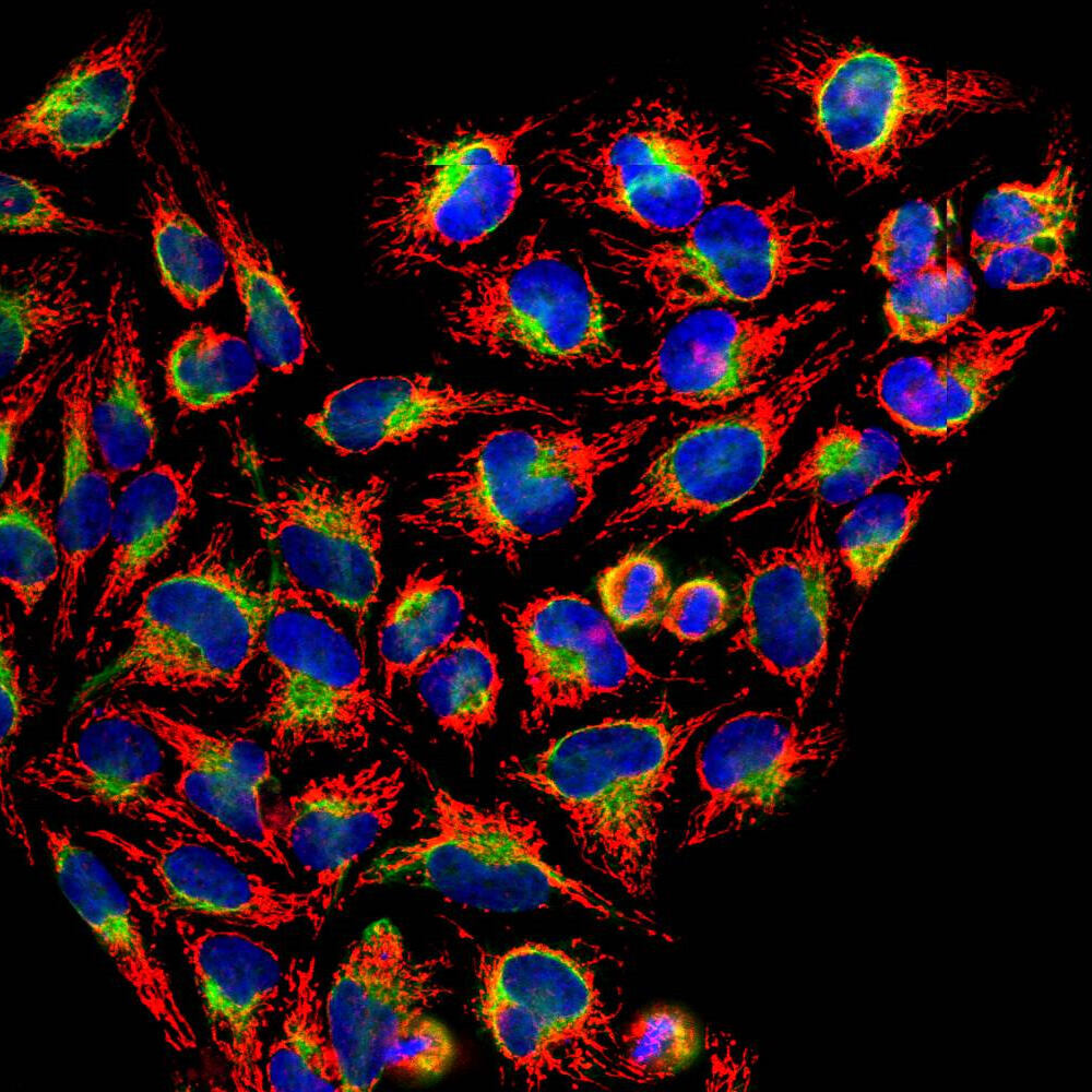 Anti-HSP60 Antibody, 100 µl
