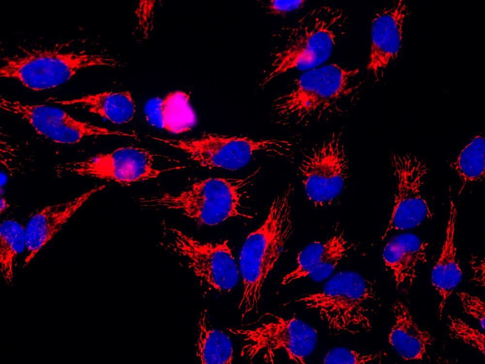 Anti-HSP60 Antibody [1C7]