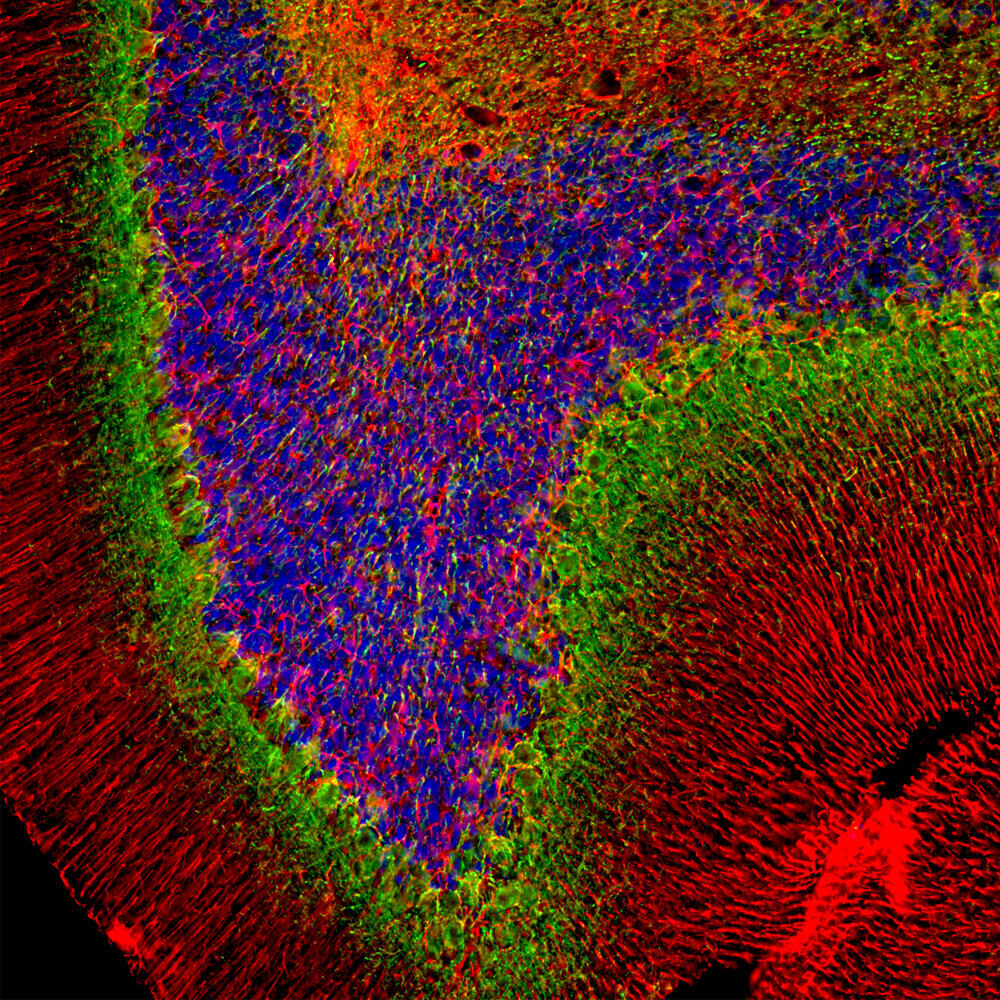 Anti-alpha Internexin Antibody