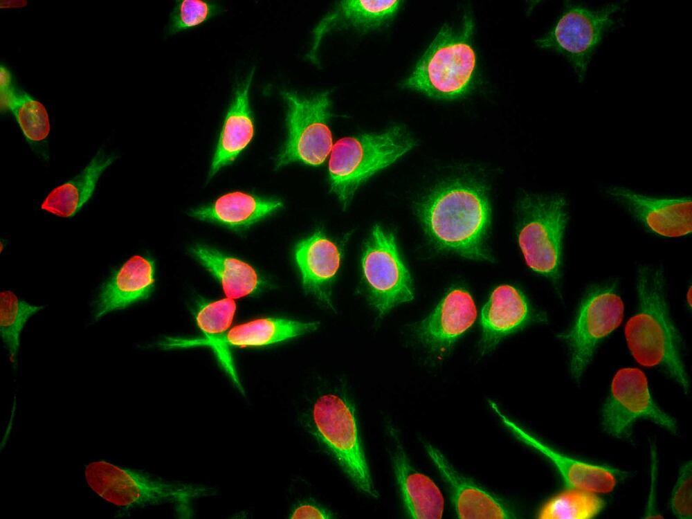 Anti-Lamin A + Lamin C Antibody [4C4]