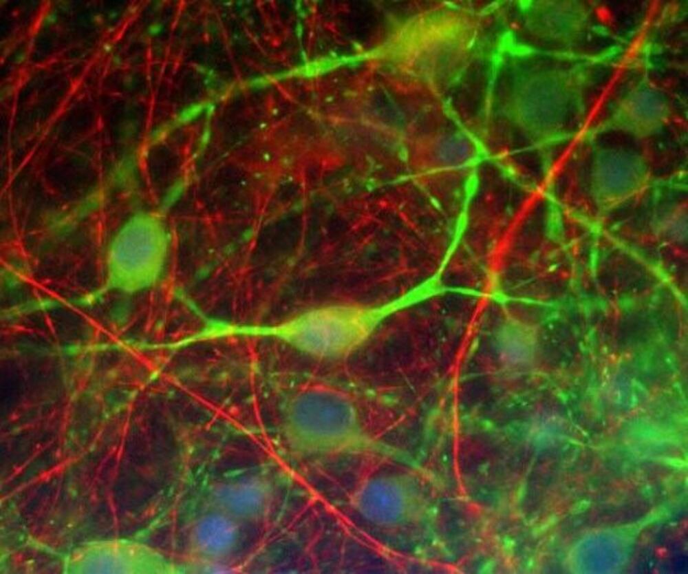 Anti-alpha Internexin Antibody [1D2]