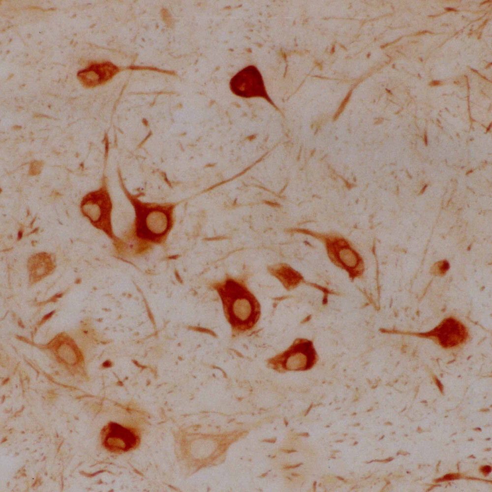 Anti-alpha Internexin Antibody [2E3], 500 µl