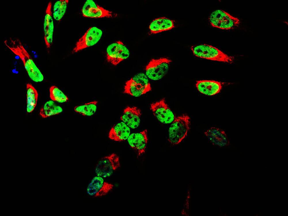 Anti-TAF15 Antibody [4D71]