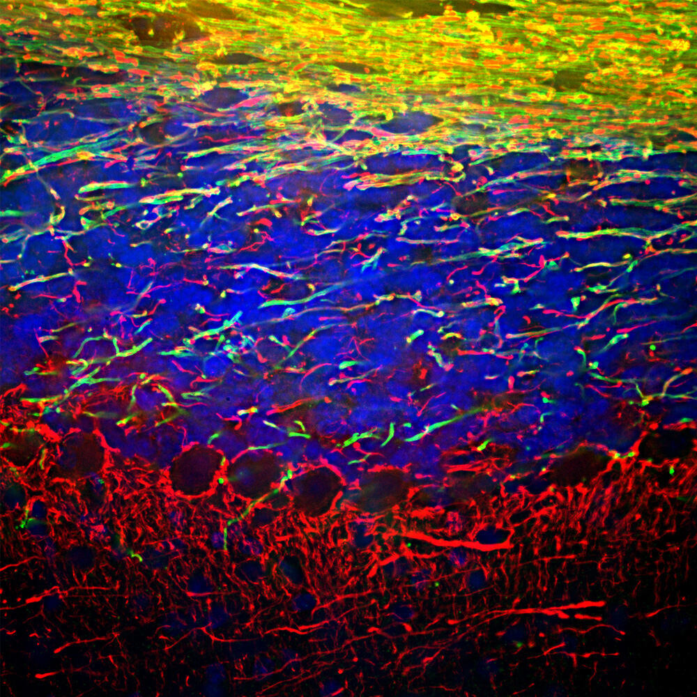 Anti-NF-L Antibody
