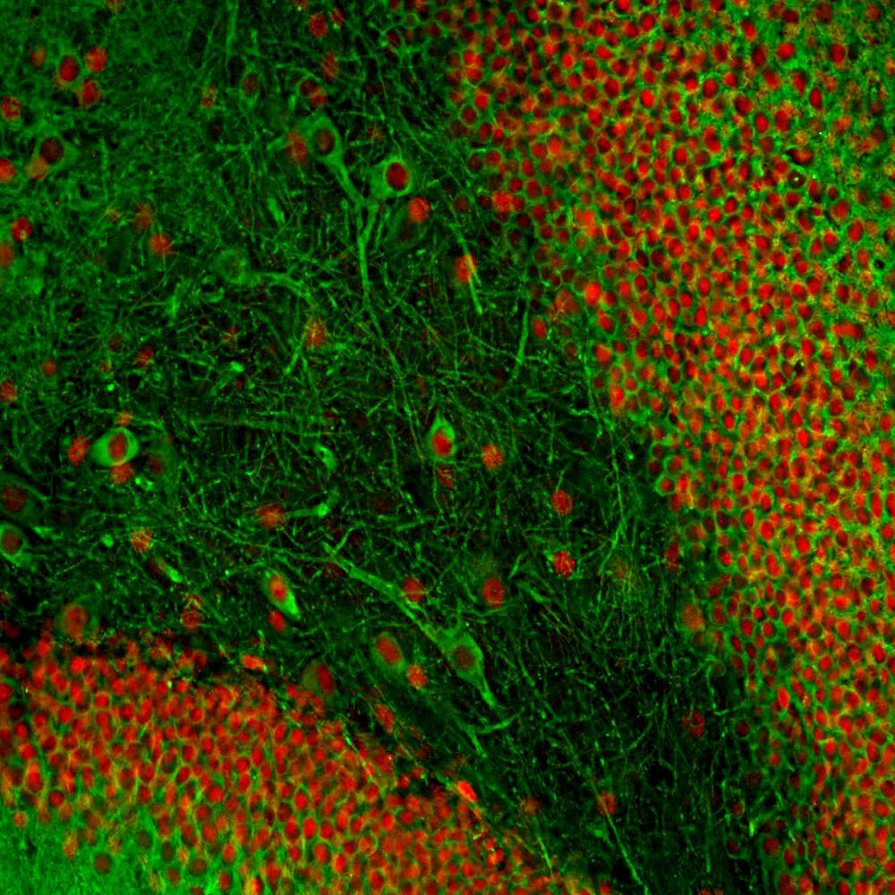Anti-MAP2 Antibody [2C4], 100 µl