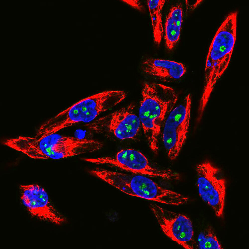 Anti-Fibrillarin Antibody, 100 µl