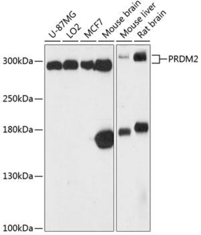 Anti-RIZ1 Antibody