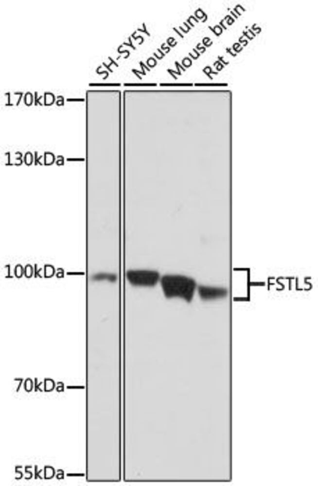 Anti-FSTL5 Antibody, 100 µl