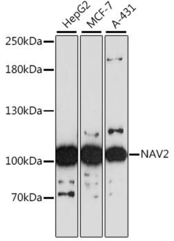 Anti-NAV2 Antibody, 100 µl