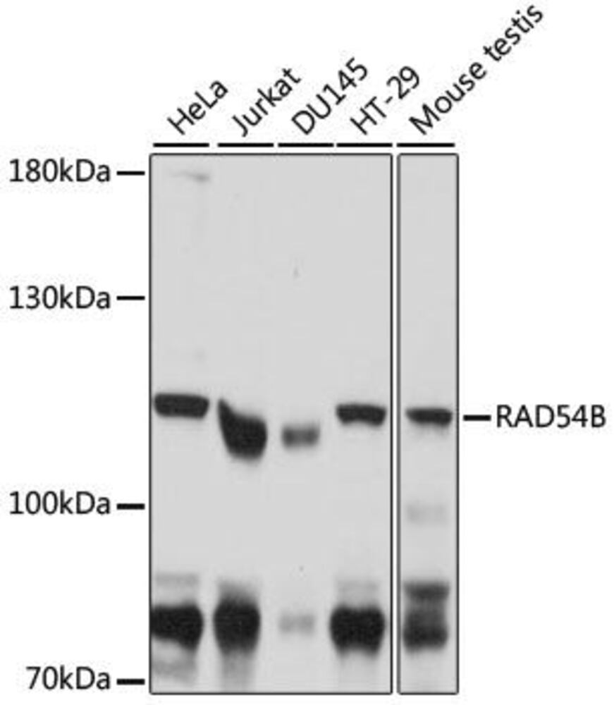 Anti-RAD54B Antibody, 100 µl