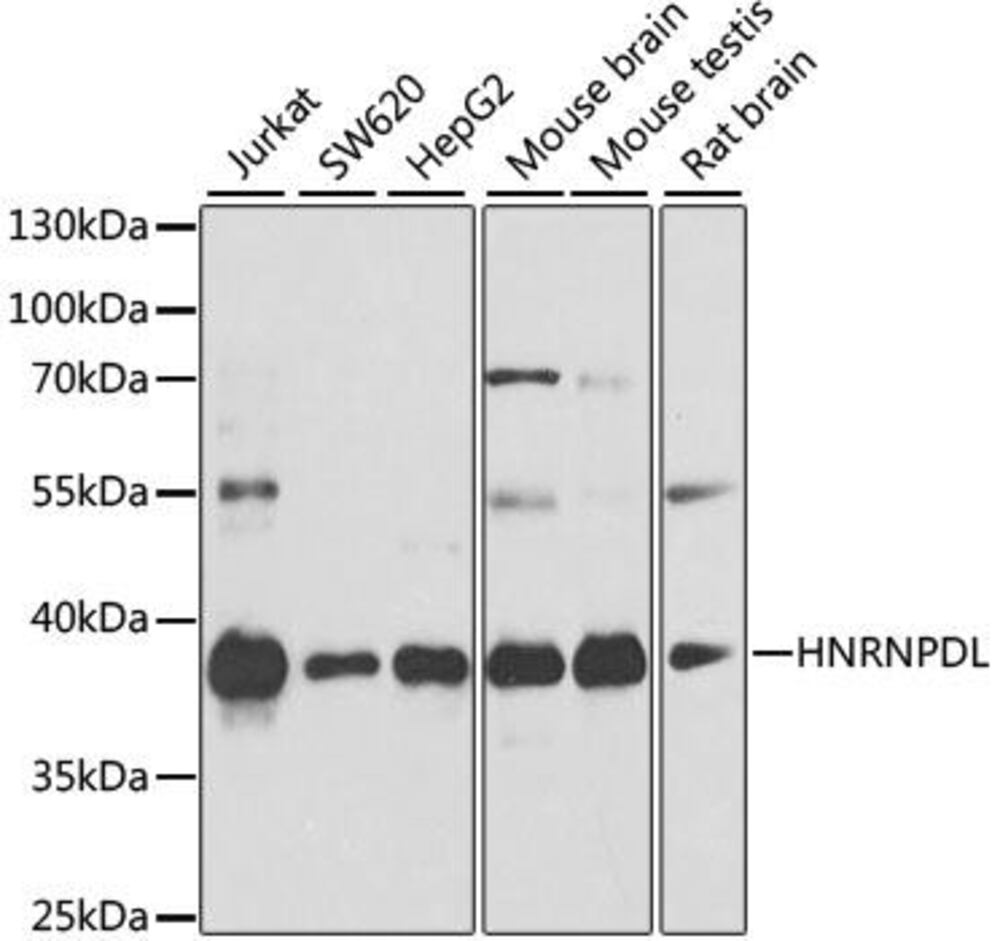 Anti-HNRPDL Antibody, 100 µl