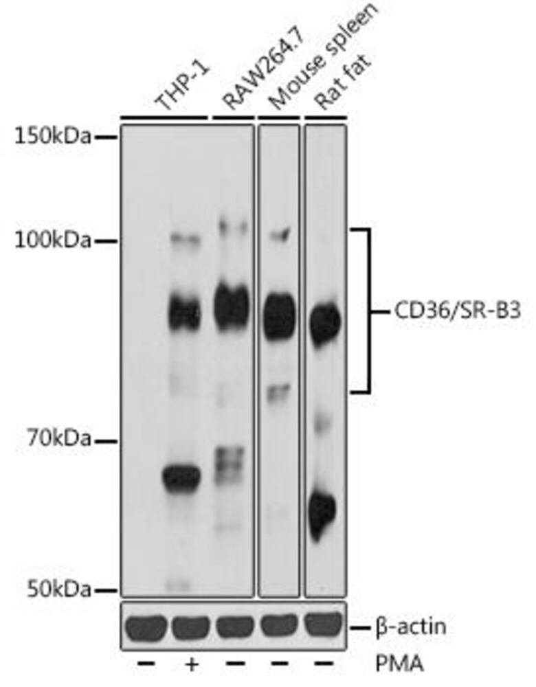 Anti-CD36 Antibody, 100 µl