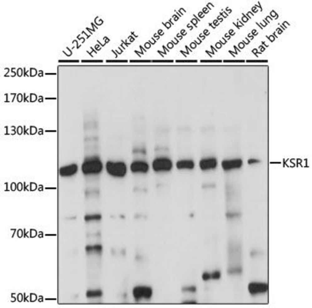 Anti-KSR1 Antibody, 100 µl