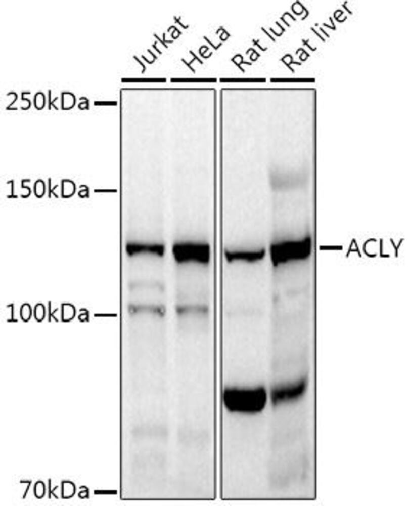 Anti-ATP citrate lyase Antibody, 100 µl