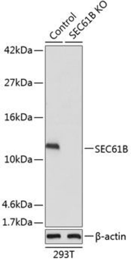 Anti-SEC61B Antibody, 100 µl