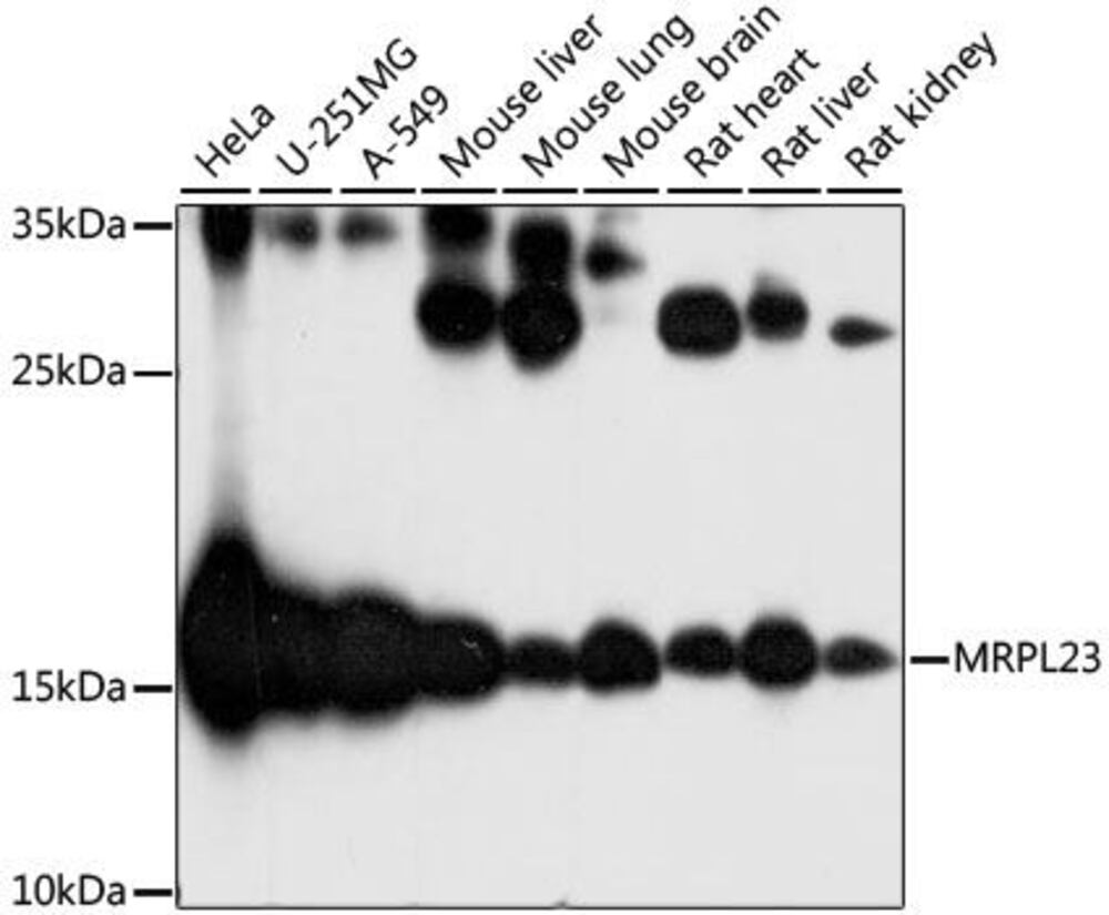 Anti-MRPL23 Antibody, 100 µl