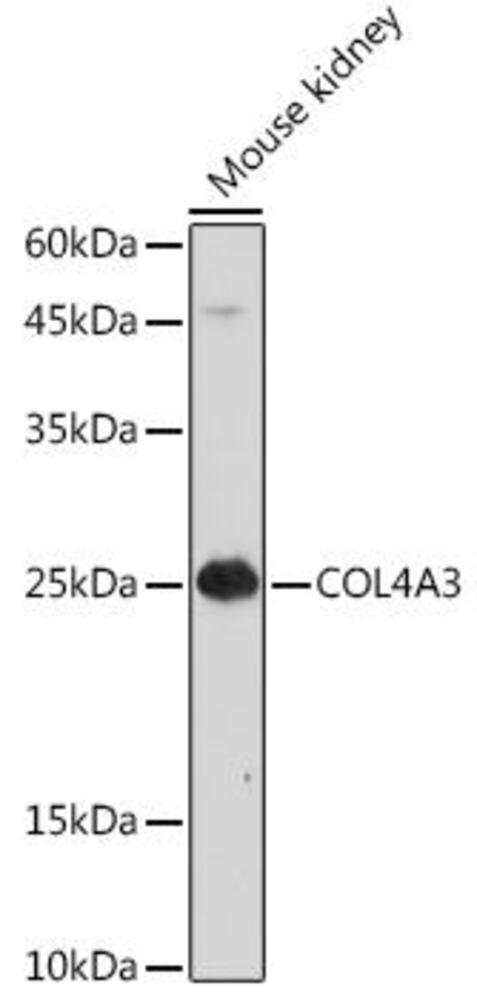 Anti-COL4A3 Antibody, 100 µl