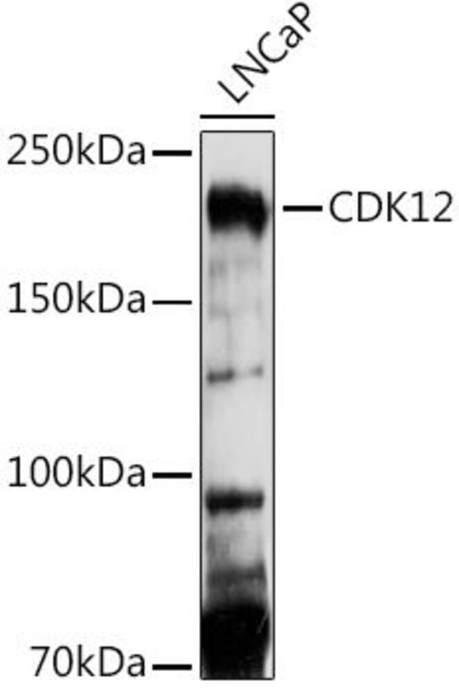 Anti-CDK12 Antibody, 100 µl