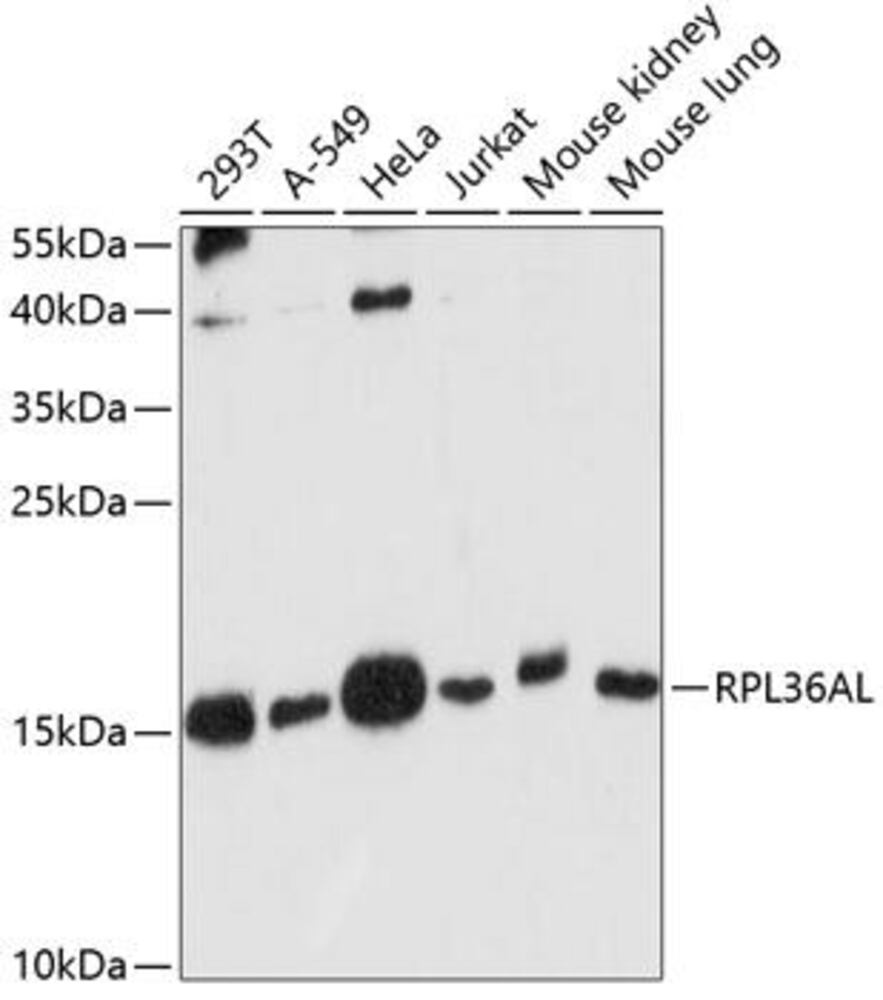 Anti-RPL36AL Antibody