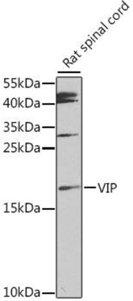 Anti-VIP Antibody