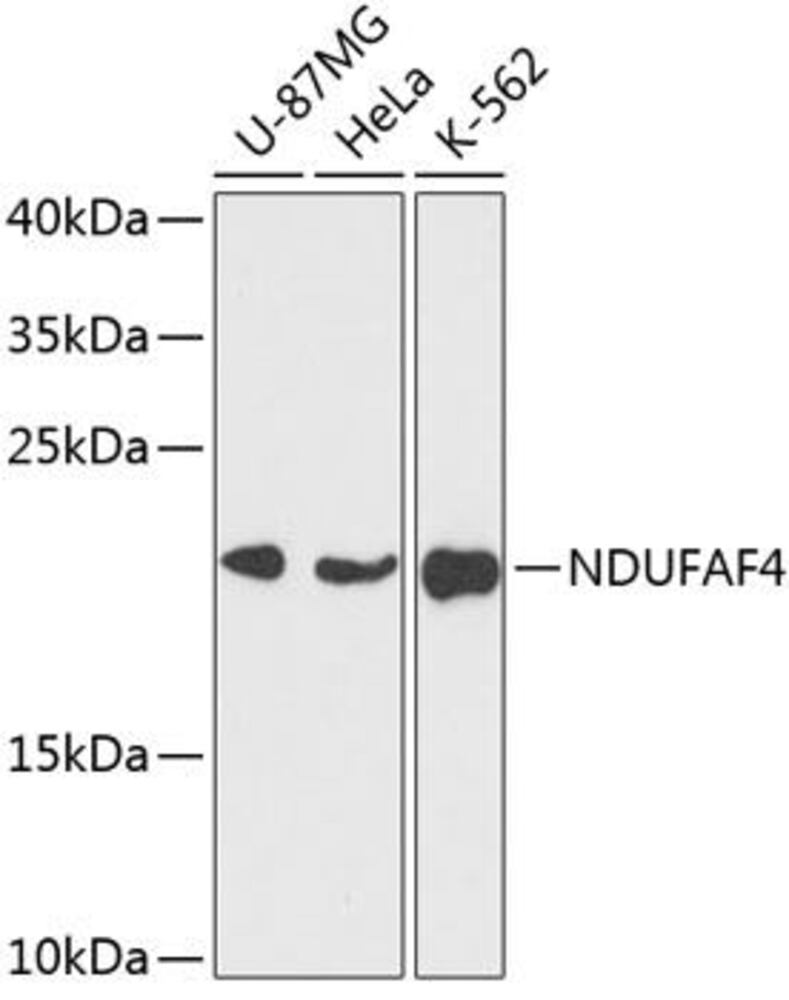 Anti-NDUFAF4 Antibody, 100 µl