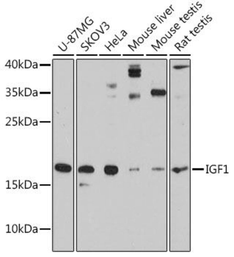 Anti-IGF1 Antibody