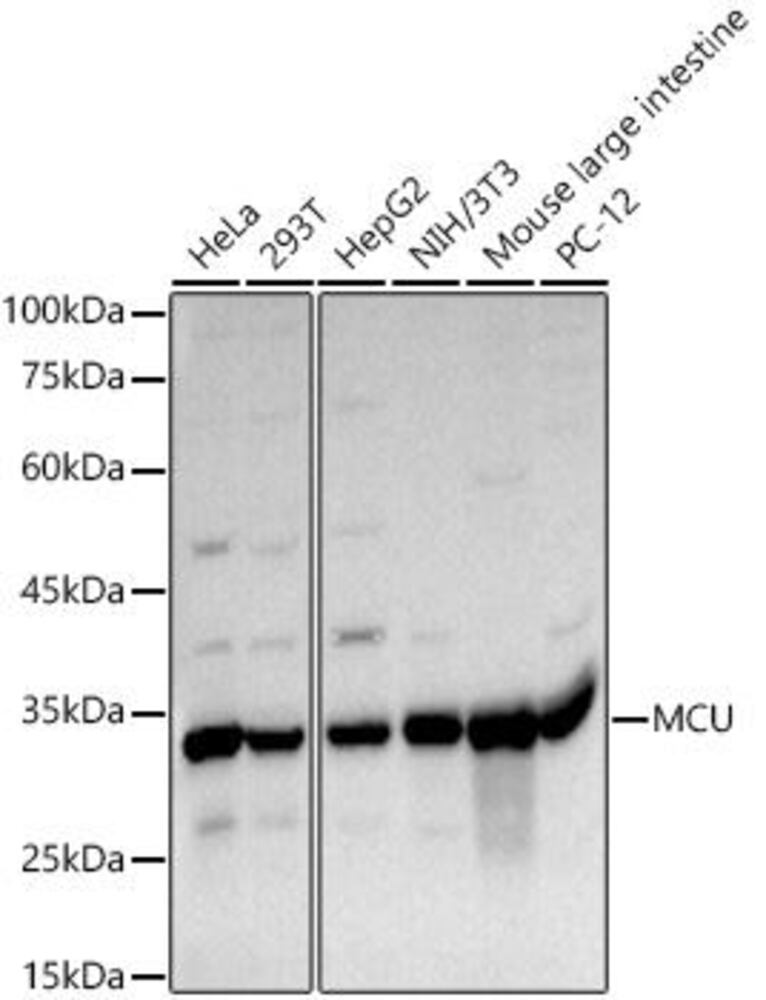 Anti-MCU Antibody, 100 µl