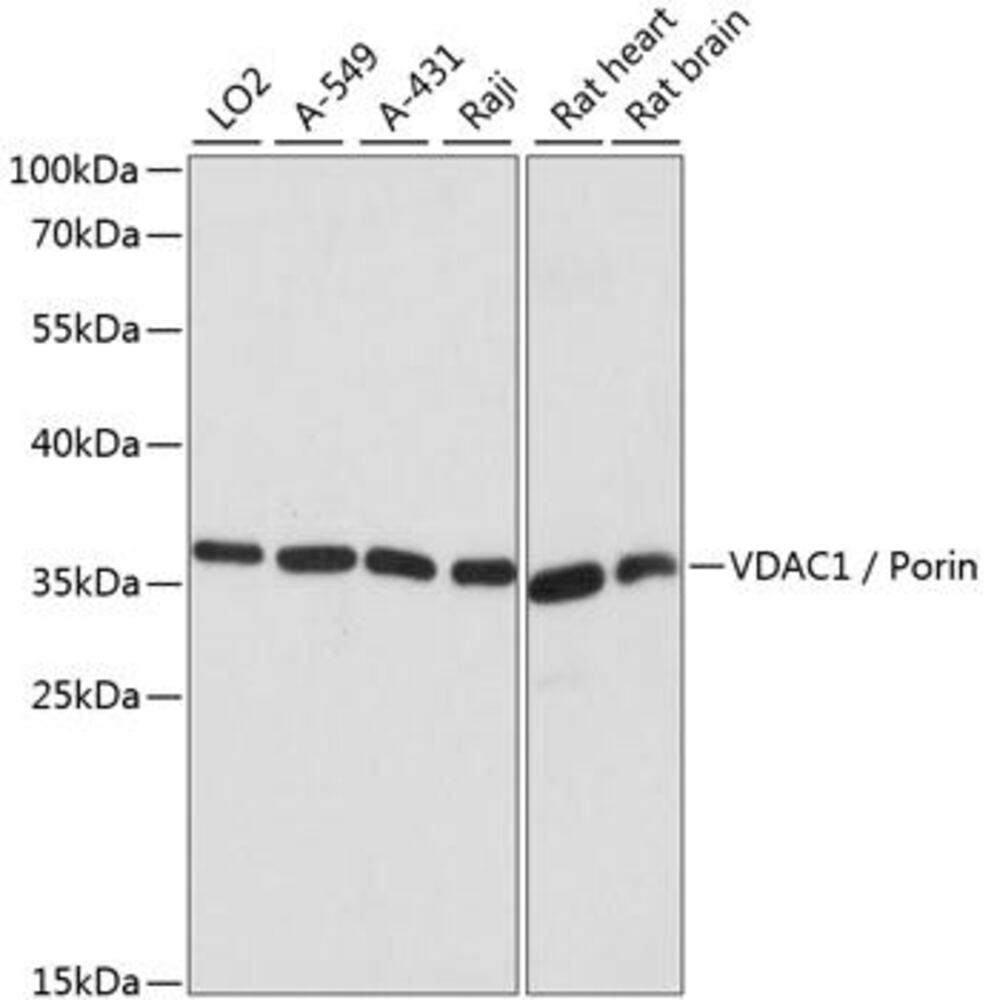 Anti-VDAC1/Porin Antibody