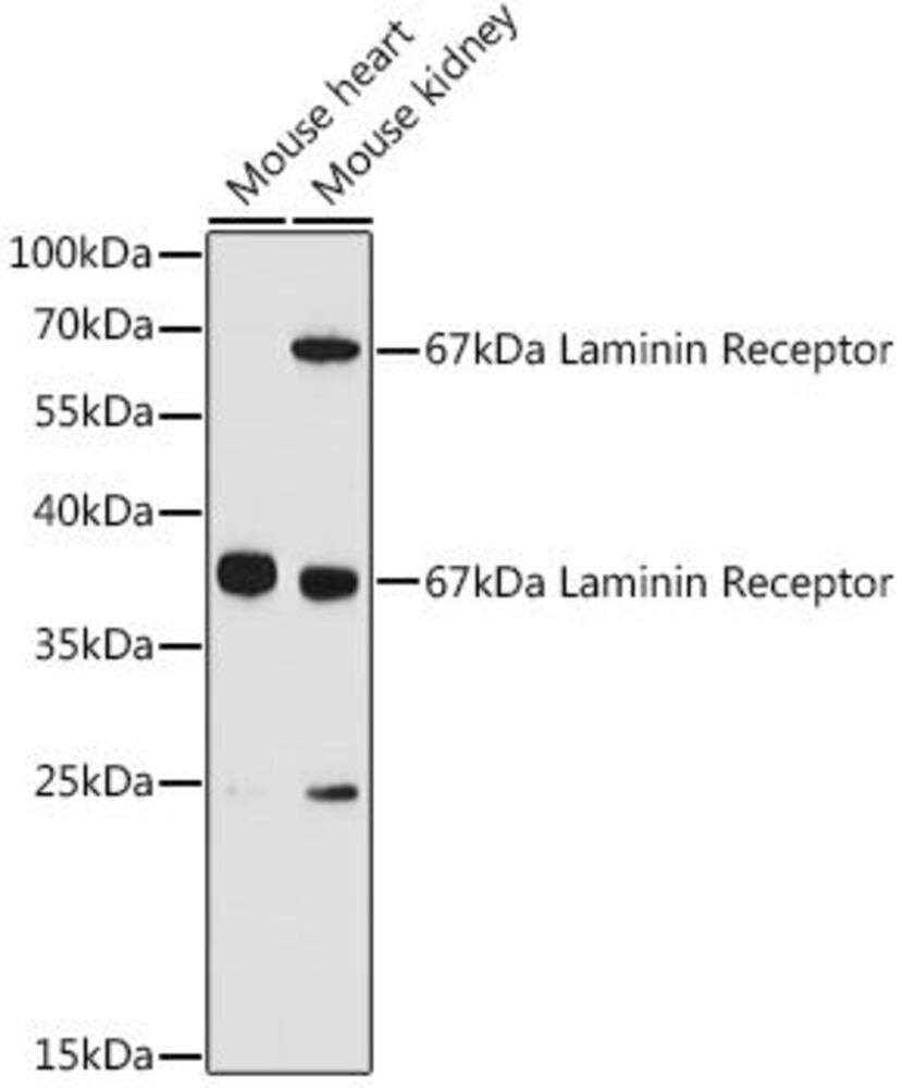 Anti-67kDa Laminin Receptor Antibody