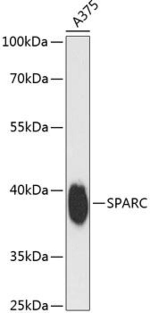 Anti-SPARC Antibody, 100 µl