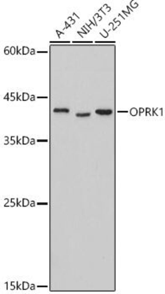 Anti-Kappa Opioid Receptor Antibody, 100 µl