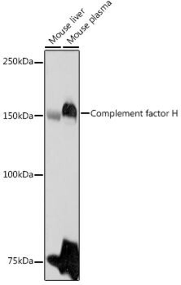 Anti-Factor H Antibody, 100 µl
