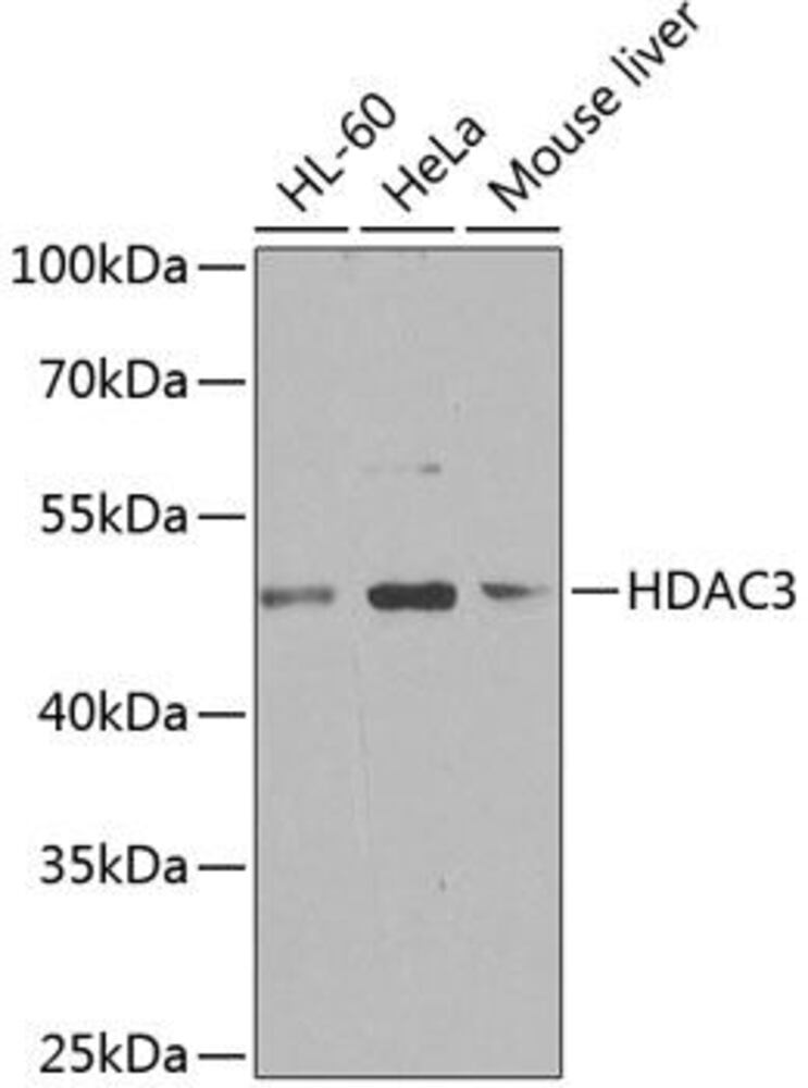 Anti-HDAC3 Antibody, 100 µl