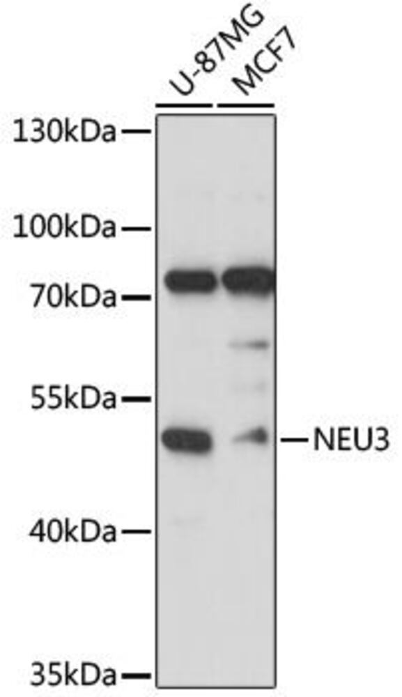 Anti-Sialidase-3 Antibody, 100 µl