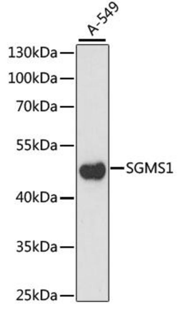 Anti-Sphingomyelin Synthase 1 Antibody, 100 µl