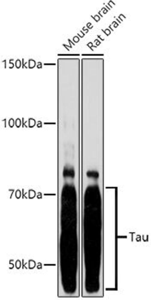 Anti-Tau Antibody