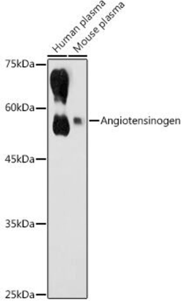 Anti-Angiotensinogen Antibody, 100 µl