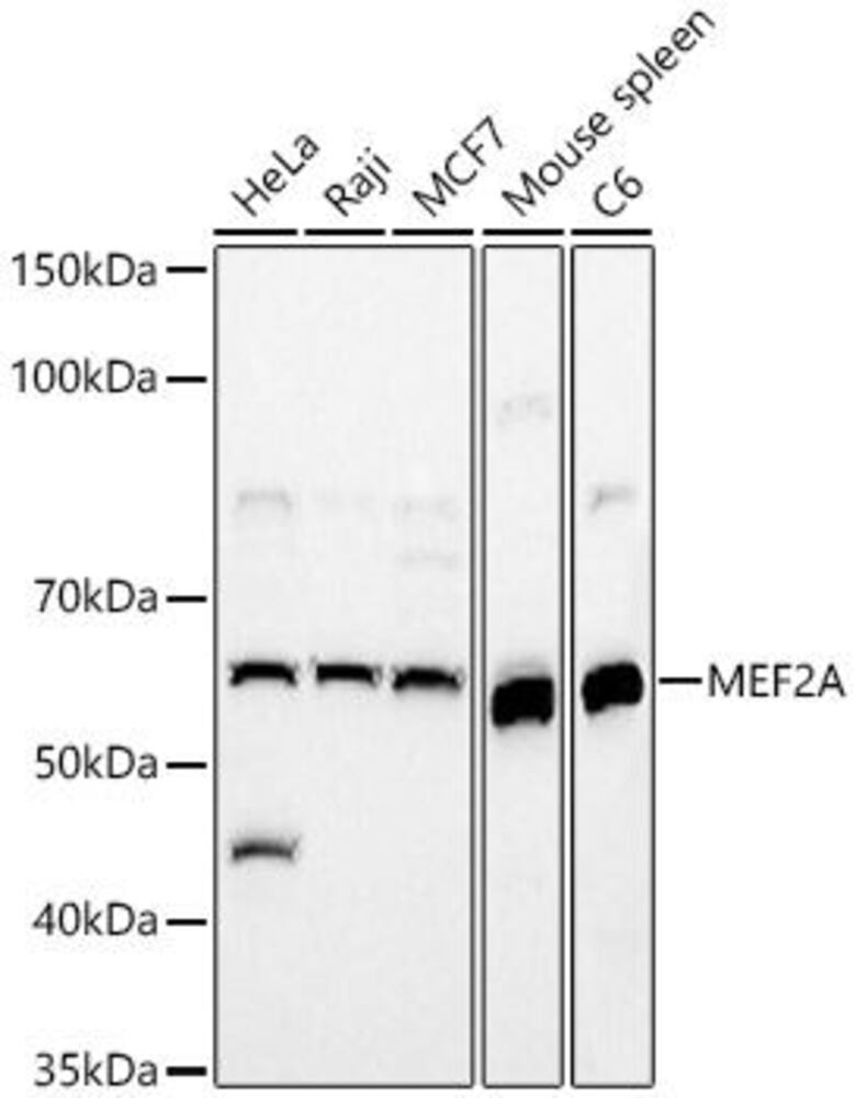 Anti-MEF2A Antibody, 100 µl